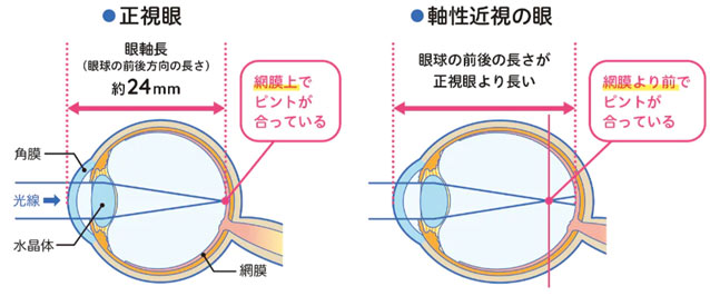 リジュセアミニ点眼薬